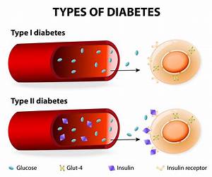 Type One Diabetes: Smallest book with everything you need to know